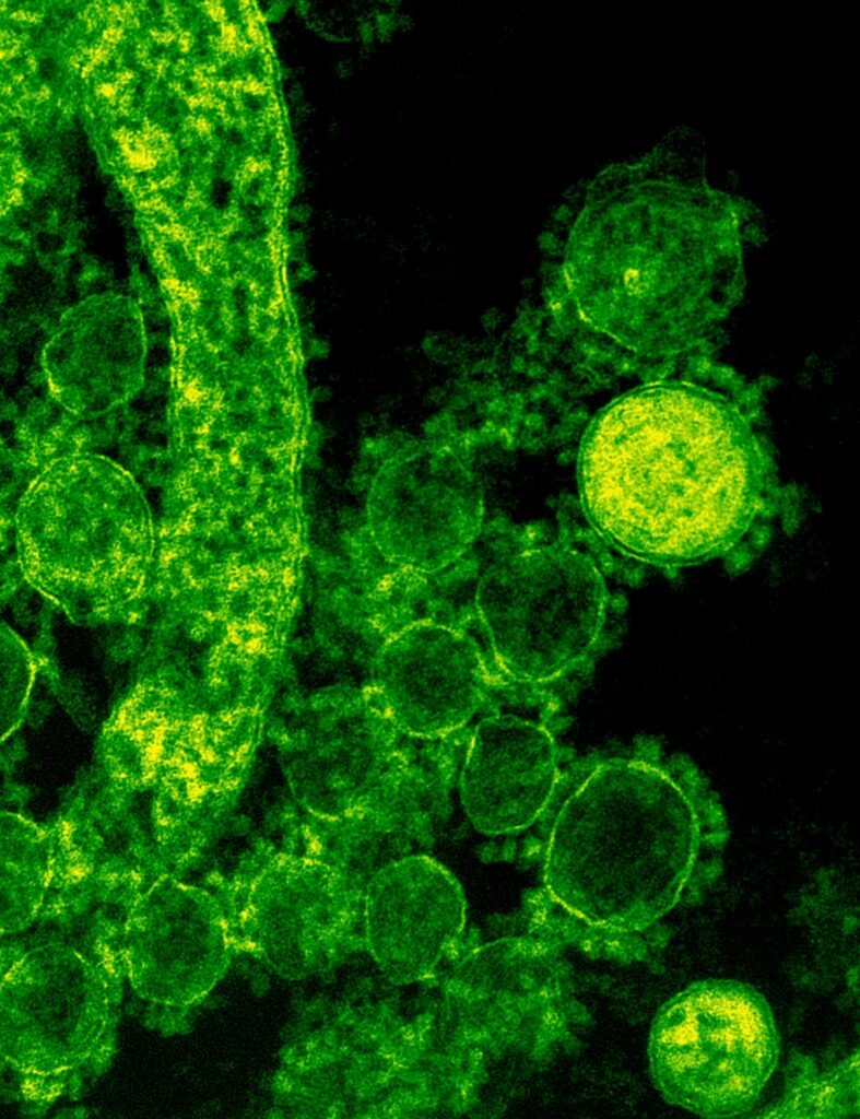 Bacteria if you dont Clean and Sanitize Your RV's Fresh Water Tank